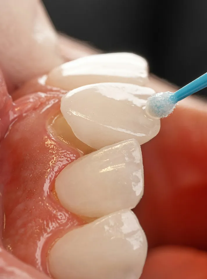 A description of my image.