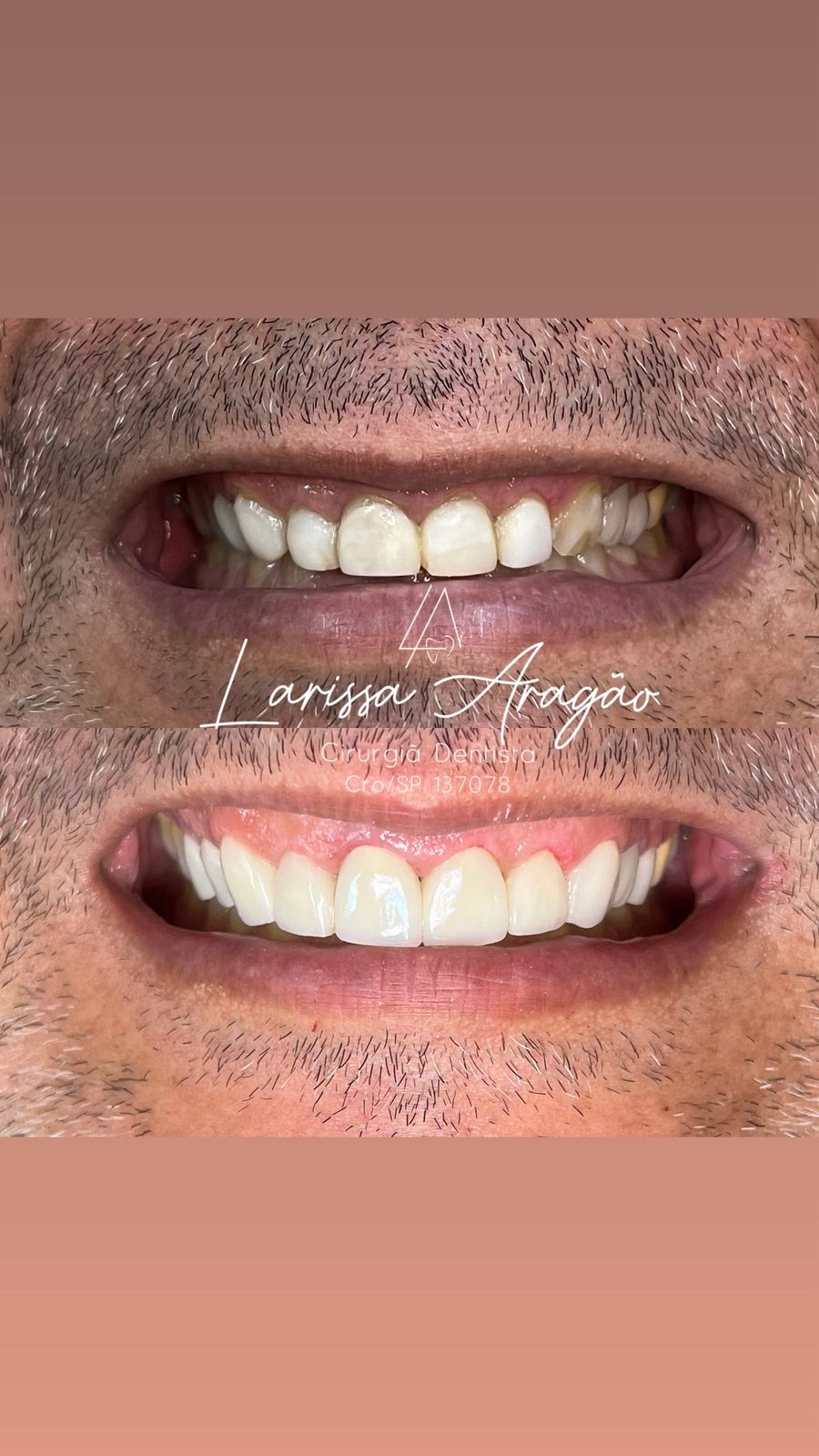 Dental treatment result