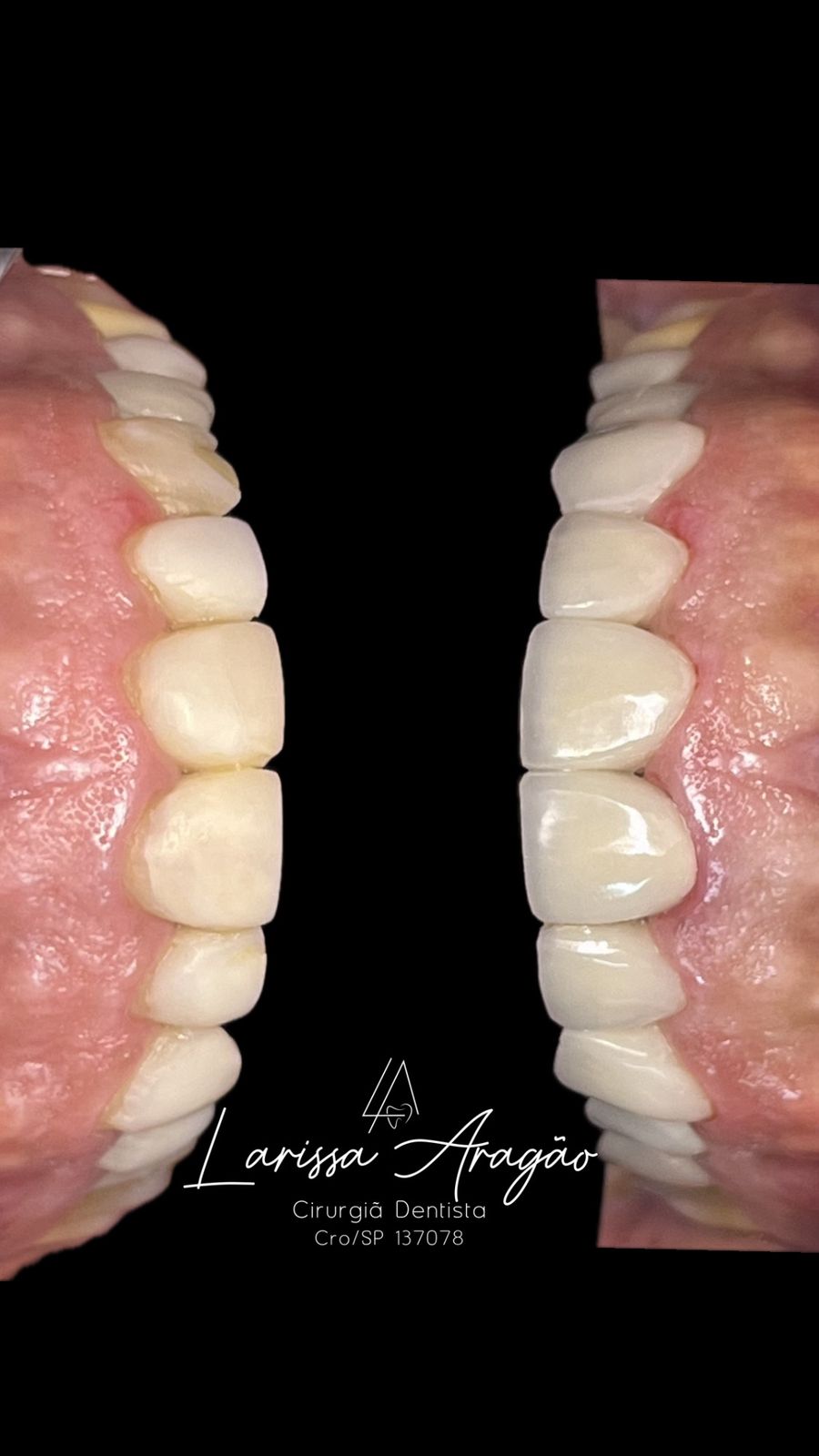 Dental treatment result