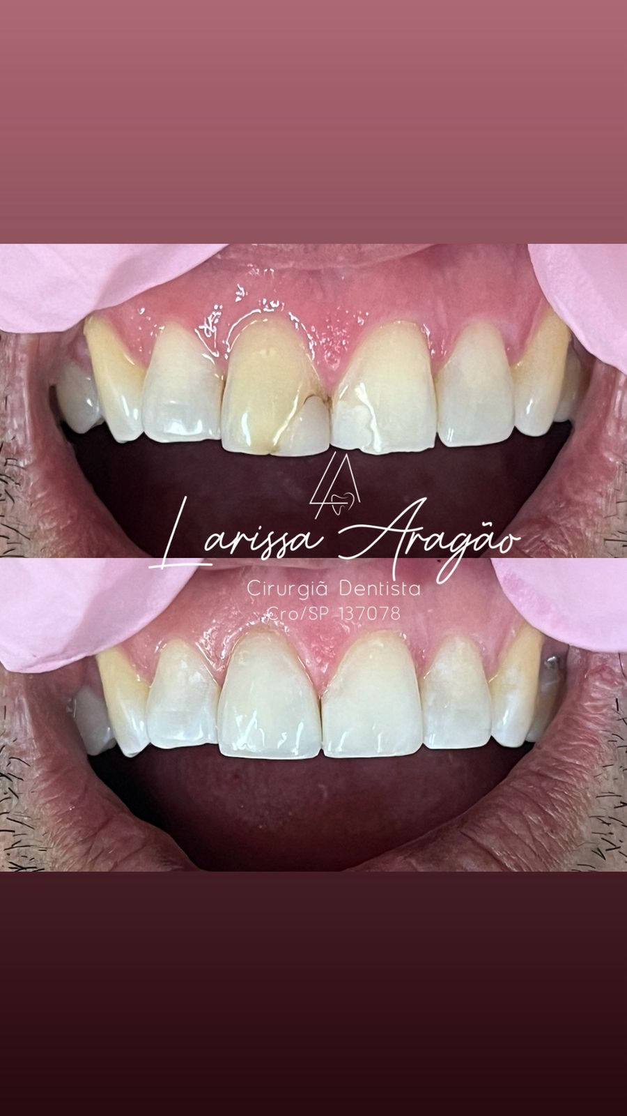 Dental treatment result