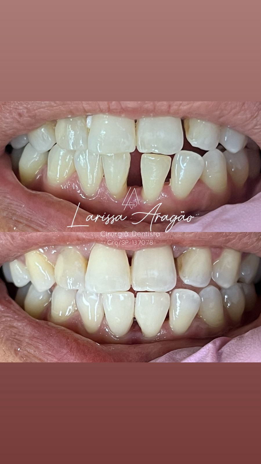 Dental treatment result