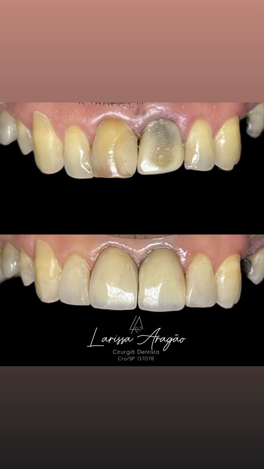 Dental treatment result