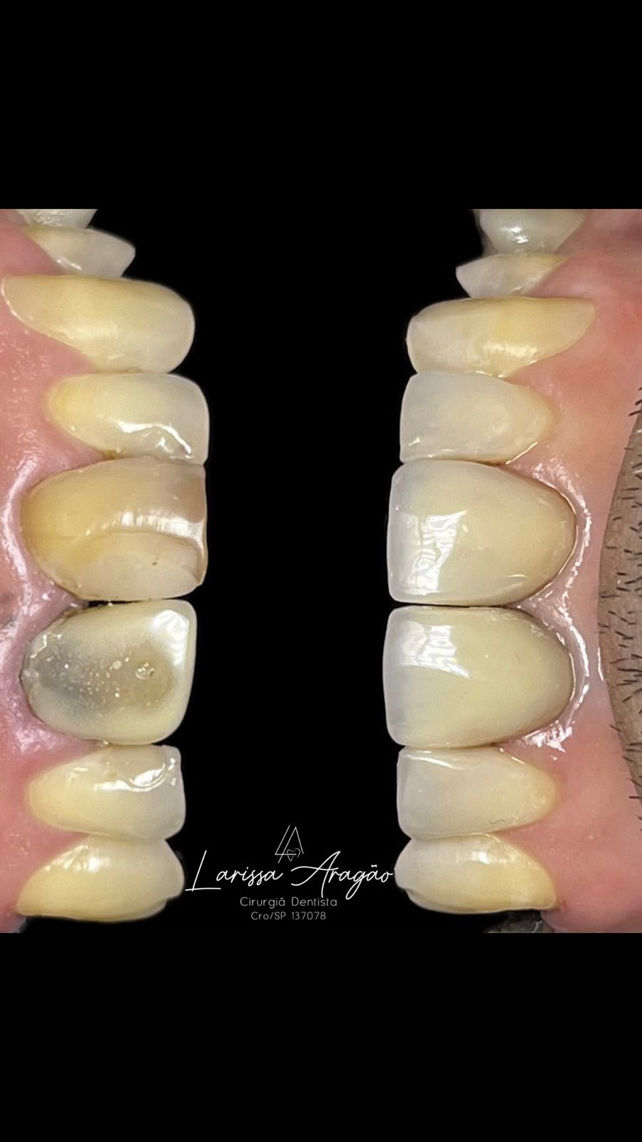 Dental treatment result